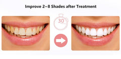 LED light for teeth whitening